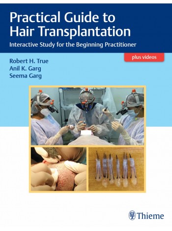 Practical Guide to Hair Transplantation